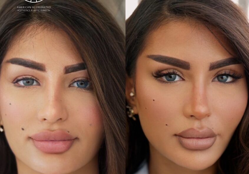 Non surgical